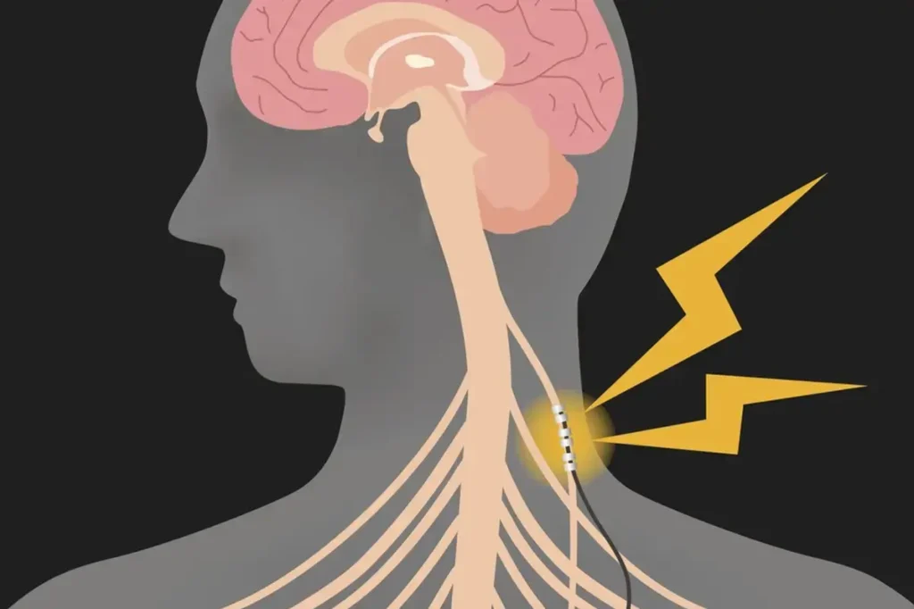 role-of-vagus-nerve-in-gut-brain-connection